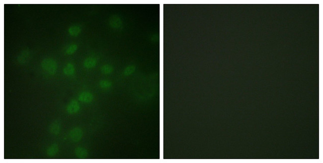 Phospho-TERT (Ser227) Antibody in Immunocytochemistry (ICC/IF)