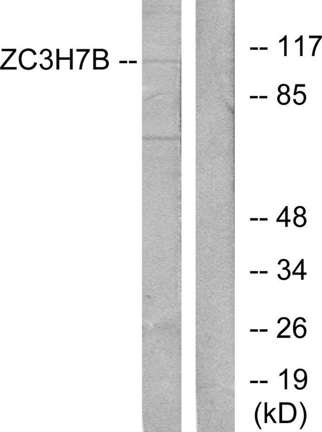 ZC3H7B Antibody in Western Blot (WB)