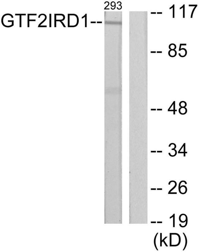 GTF2IRD1 Antibody in Western Blot (WB)