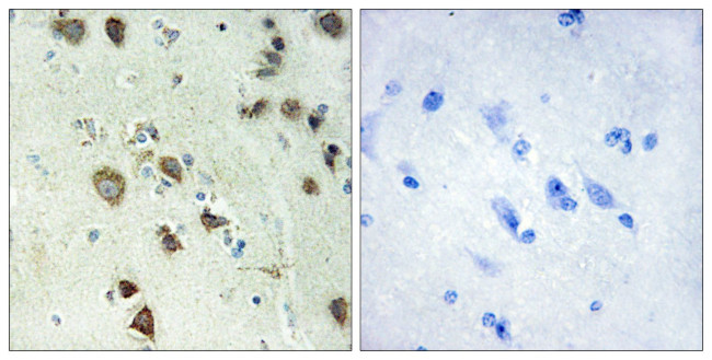 RSK4 Antibody in Immunohistochemistry (Paraffin) (IHC (P))
