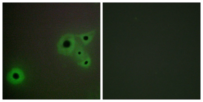 CRSP130 Antibody in Immunocytochemistry (ICC/IF)