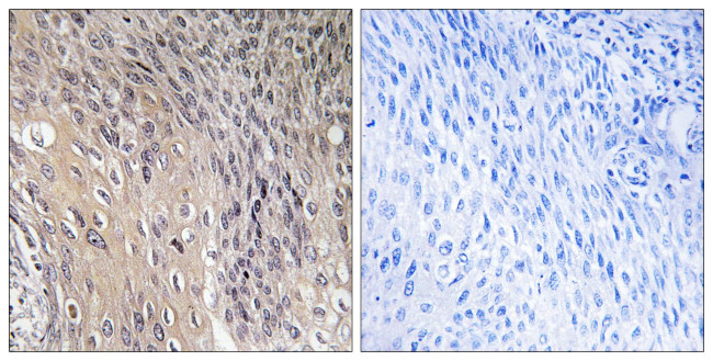 Phospho-RhoGDI (Ser174) Antibody in Immunohistochemistry (Paraffin) (IHC (P))