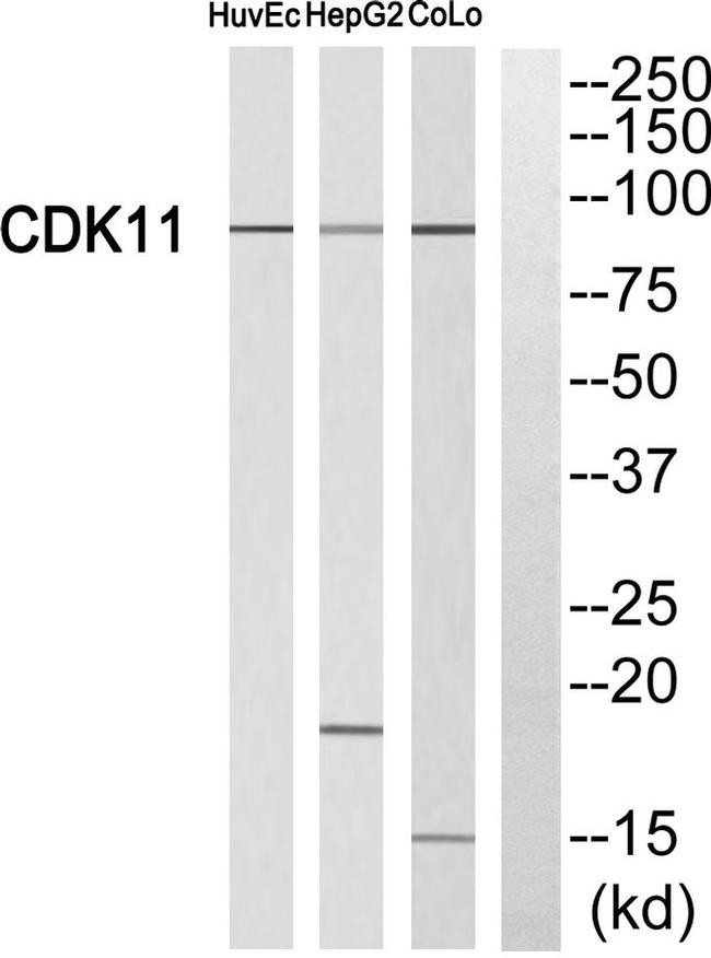 CDK11A/CDK11B Antibody in Western Blot (WB)