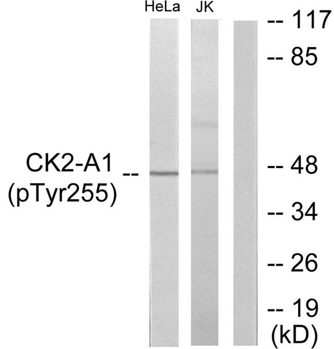 Phospho-CK2 alpha-1 (Tyr255) Antibody in Western Blot (WB)