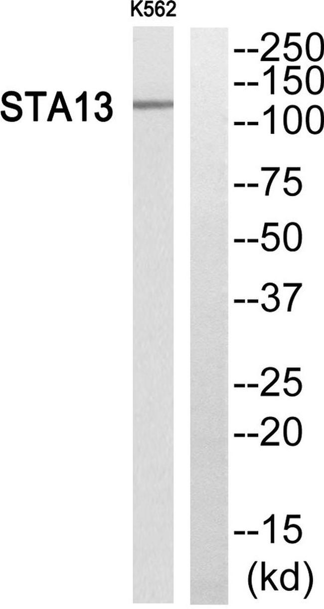 STARD13 Antibody in Western Blot (WB)