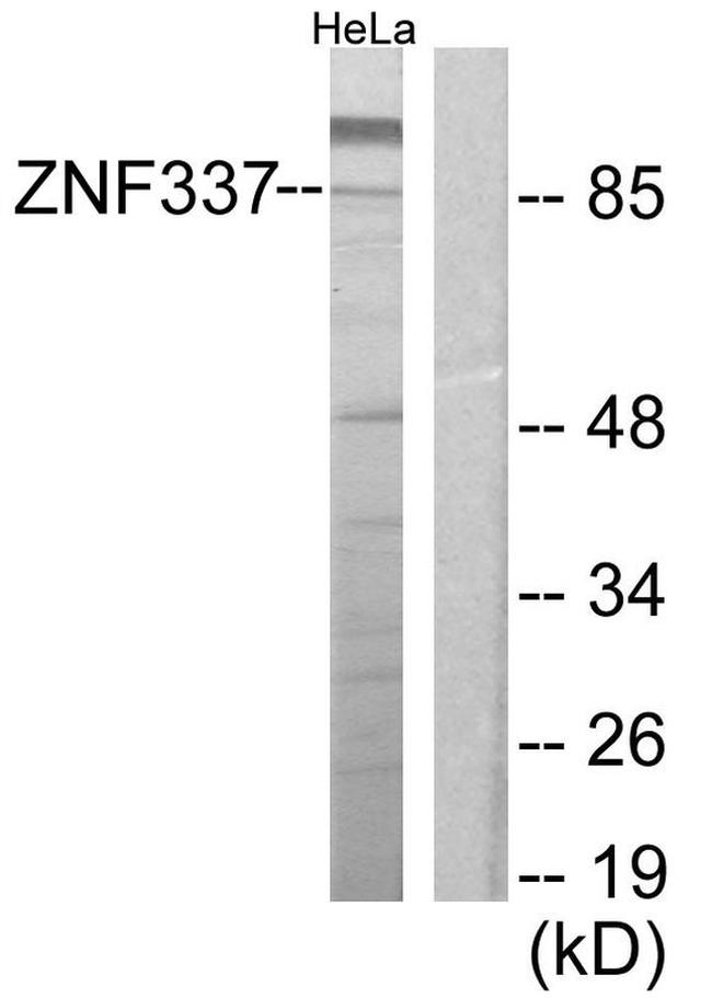 ZNF337 Antibody in Western Blot (WB)
