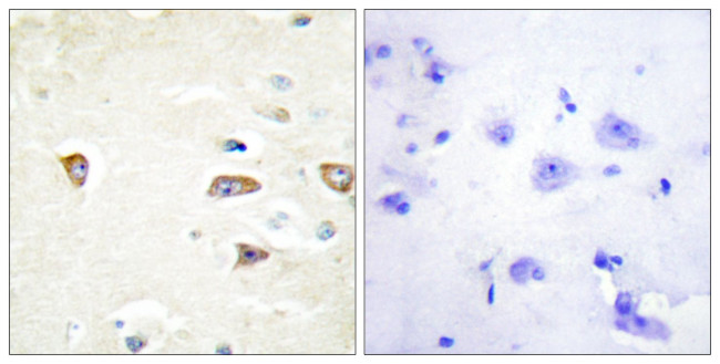 MRCK beta Antibody in Immunohistochemistry (Paraffin) (IHC (P))