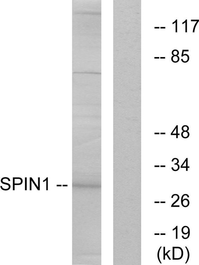 SPIN1 Antibody in Western Blot (WB)