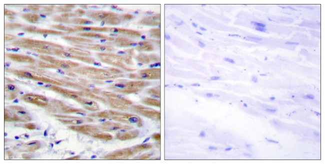 MEKK4 Antibody in Immunohistochemistry (Paraffin) (IHC (P))