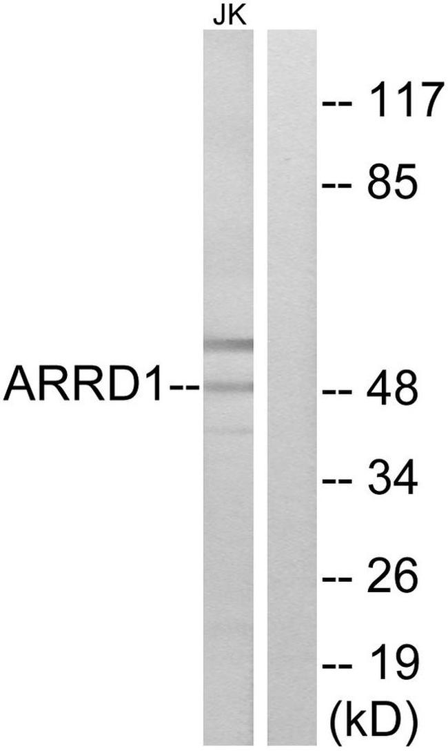 ARRDC1 Antibody in Western Blot (WB)