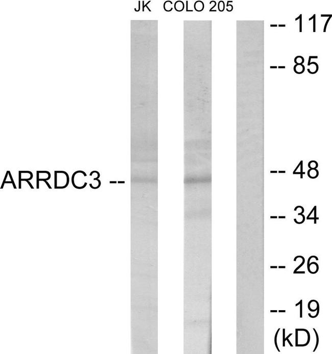 ARRDC3 Antibody in Western Blot (WB)