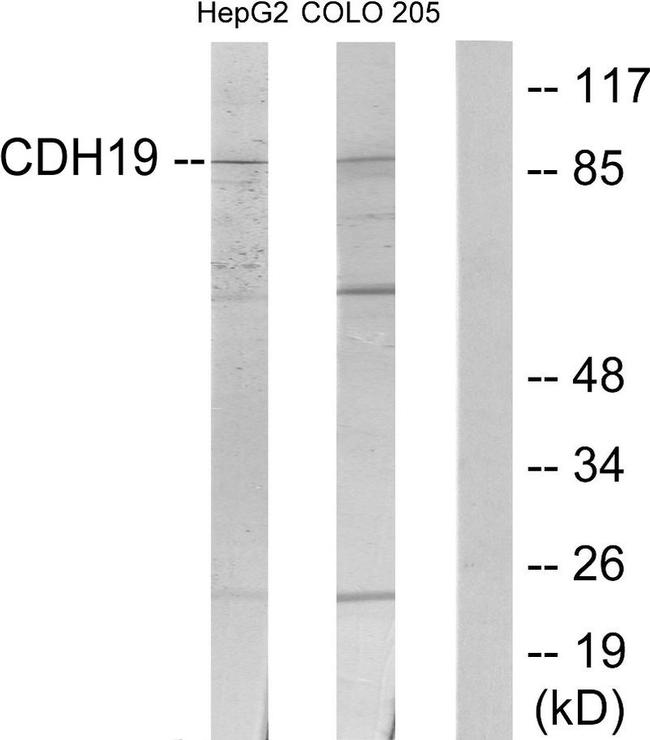 CDH19 Antibody in Western Blot (WB)