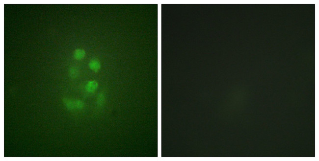 Phospho-MCAK (Ser95) Antibody in Immunocytochemistry (ICC/IF)
