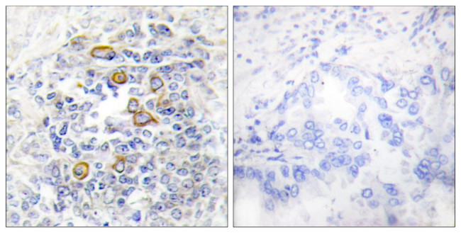 CD83 Antibody in Immunohistochemistry (Paraffin) (IHC (P))