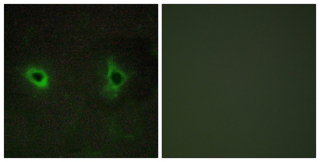 COL4A3 Antibody in Immunocytochemistry (ICC/IF)
