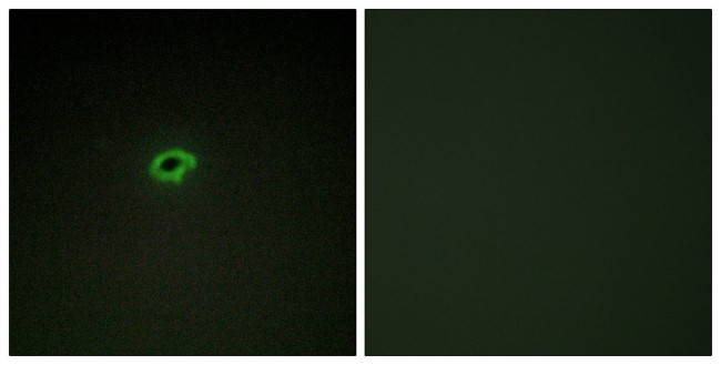 COL4A4 Antibody in Immunocytochemistry (ICC/IF)