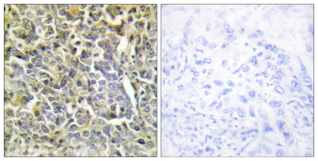 COL6A2 Antibody in Immunohistochemistry (Paraffin) (IHC (P))
