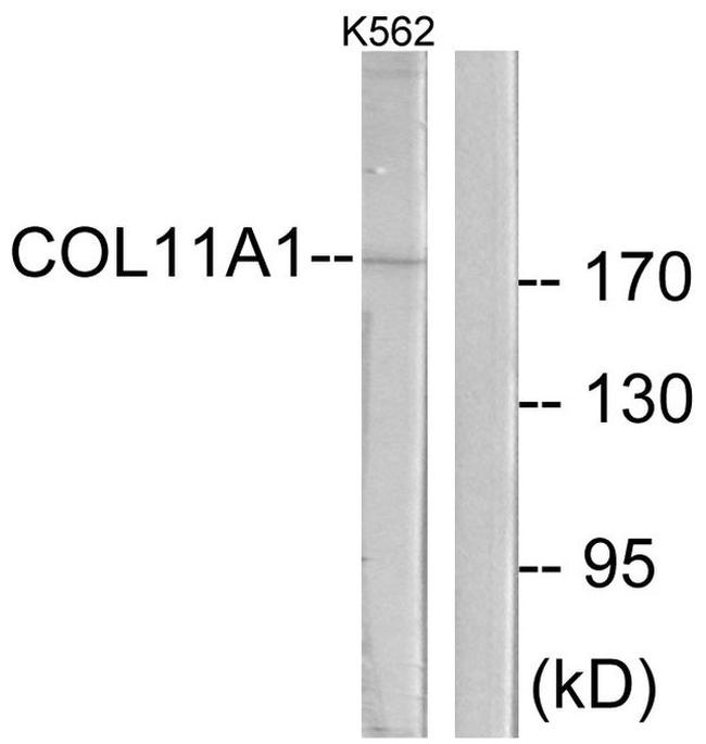 COL11A1 Antibody in Western Blot (WB)
