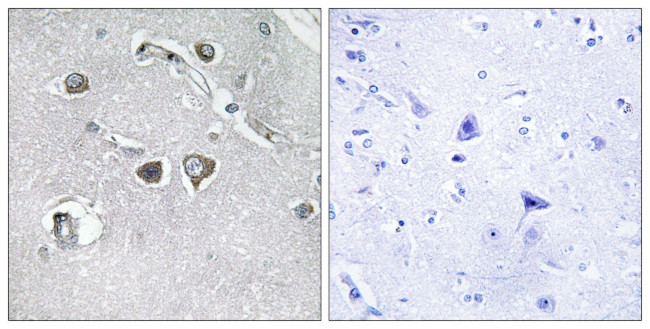 COL11A2 Antibody in Immunohistochemistry (Paraffin) (IHC (P))