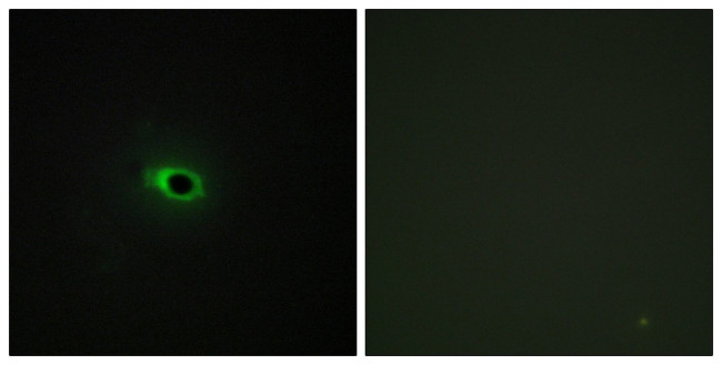 COL12A1 Antibody in Immunocytochemistry (ICC/IF)