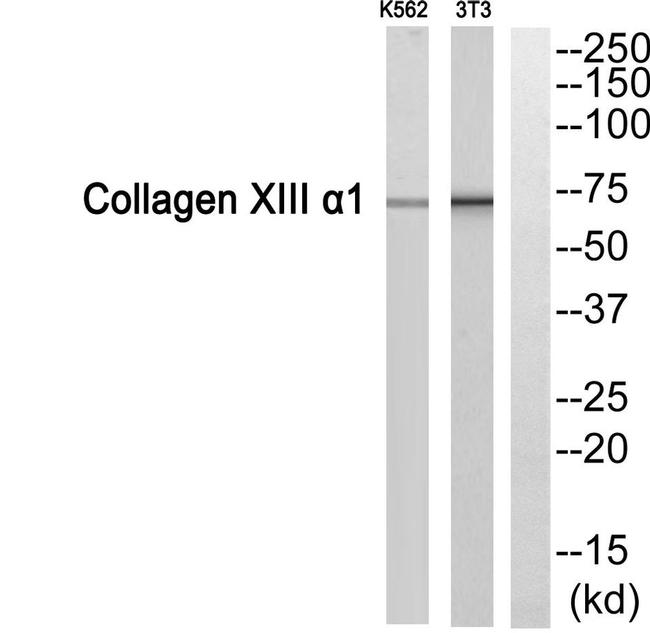 COL13A1 Antibody in Western Blot (WB)