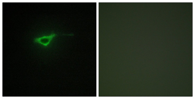 COL20A1 Antibody in Immunocytochemistry (ICC/IF)