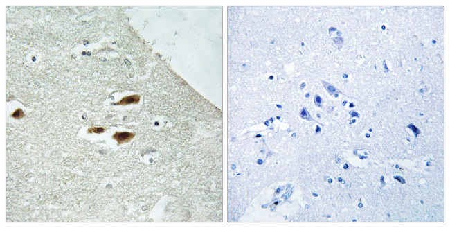 Phospho-PER2 (Ser662) Antibody in Immunohistochemistry (Paraffin) (IHC (P))
