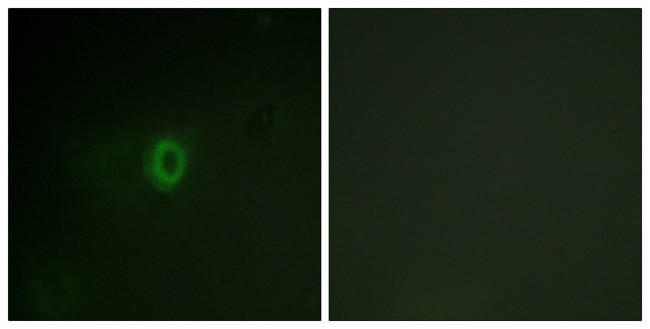 Phospho-PI3K p85/p55 (Tyr467, Tyr199) Antibody in Immunocytochemistry (ICC/IF)