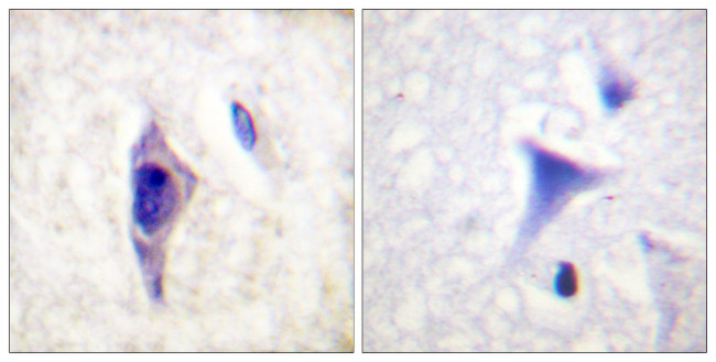 Phospho-PI3K p85 alpha (Tyr607) Antibody in Immunohistochemistry (Paraffin) (IHC (P))