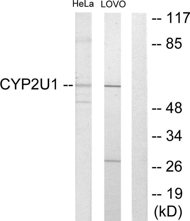 CYP2U1 Antibody in Western Blot (WB)