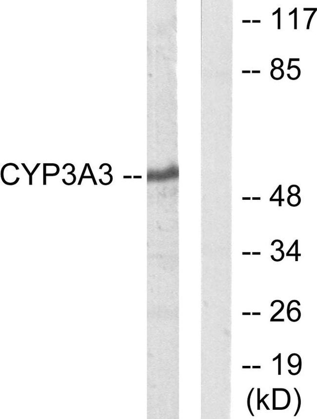 CYP3A4/CYP3A5 Antibody in Western Blot (WB)