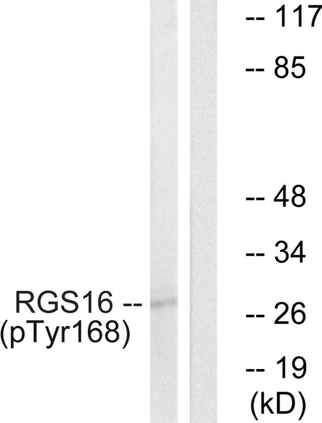 Phospho-RGS16 (Tyr168) Antibody in Western Blot (WB)