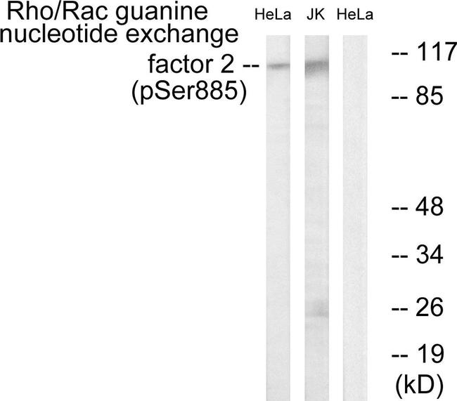 Phospho-GEF-H1 (Ser885) Antibody in Western Blot (WB)