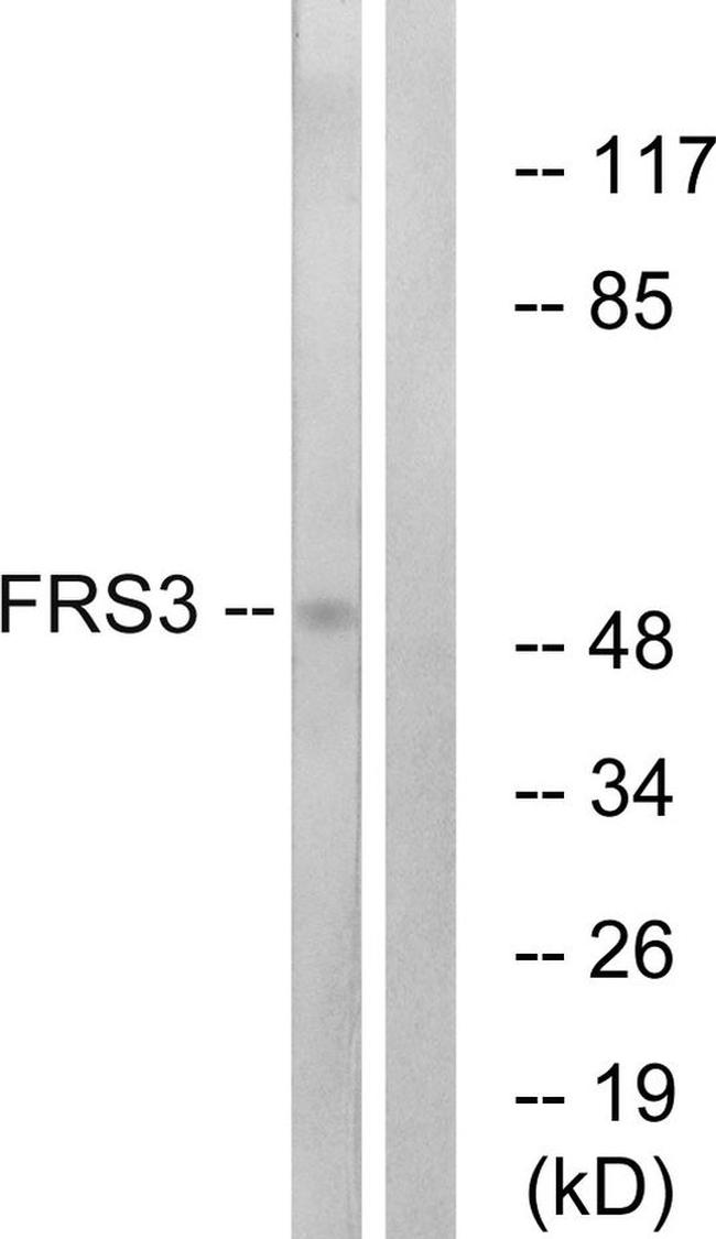 FRS3 Antibody in Western Blot (WB)