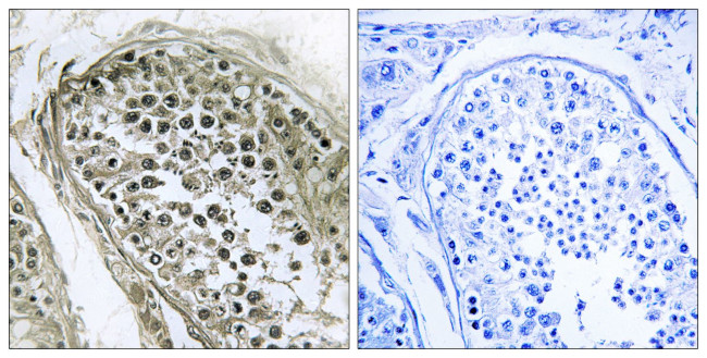 GAB4 Antibody in Immunohistochemistry (Paraffin) (IHC (P))