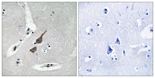 GRID1 Antibody in Immunohistochemistry (Paraffin) (IHC (P))
