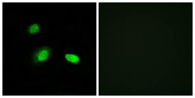 HSPB2 Antibody in Immunocytochemistry (ICC/IF)