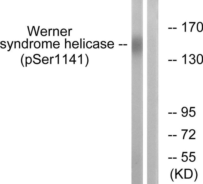 Phospho-WRN (Ser1141) Antibody in Western Blot (WB)