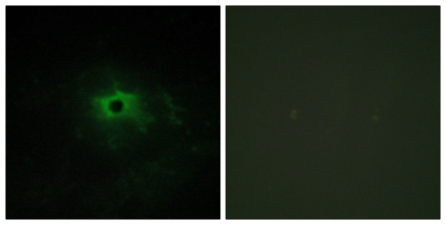 Laminin alpha-4 Antibody in Immunocytochemistry (ICC/IF)