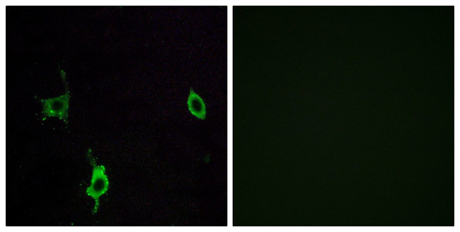 Laminin gamma-3 Antibody in Immunocytochemistry (ICC/IF)
