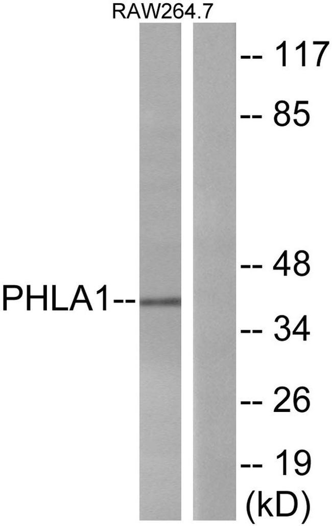 PHLDA1 Antibody in Western Blot (WB)