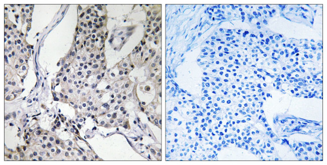 PHLDA3 Antibody in Immunohistochemistry (Paraffin) (IHC (P))