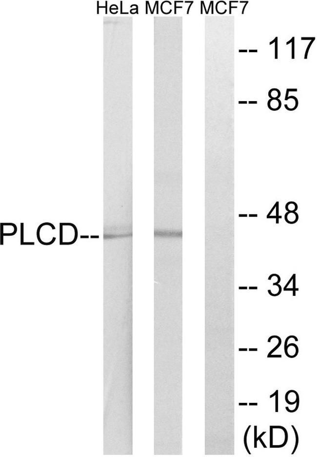 AGPAT4 Antibody in Western Blot (WB)