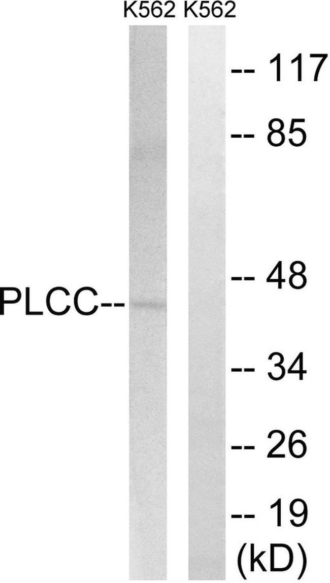 AGPAT3 Antibody in Western Blot (WB)