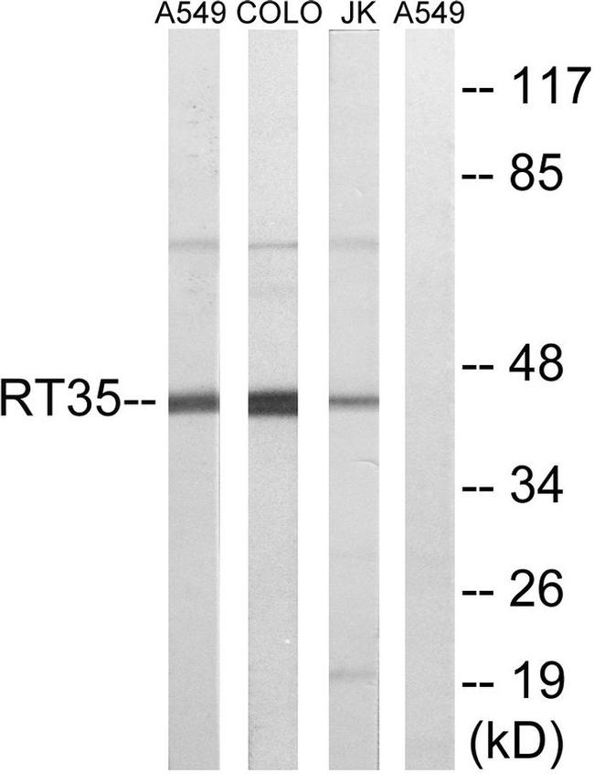 MRPS35 Antibody in Western Blot (WB)