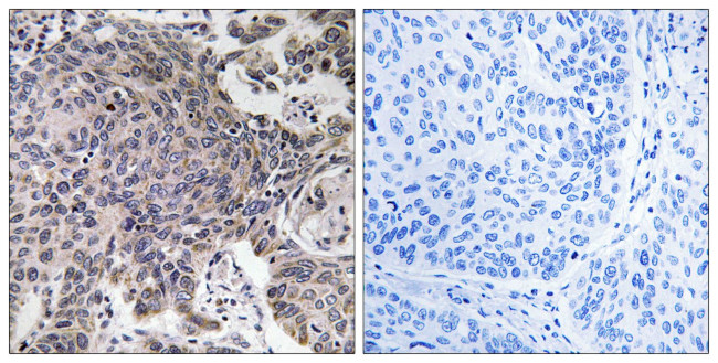 MRPL54 Antibody in Immunohistochemistry (Paraffin) (IHC (P))