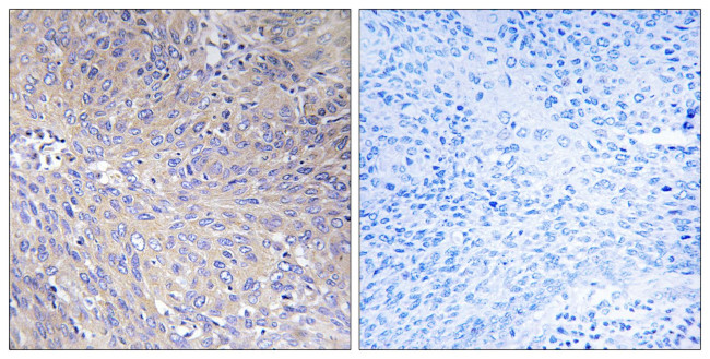 MRPL11 Antibody in Immunohistochemistry (Paraffin) (IHC (P))