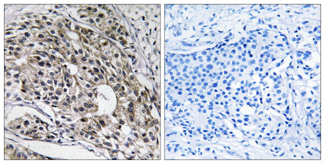 MRPL13 Antibody in Immunohistochemistry (Paraffin) (IHC (P))