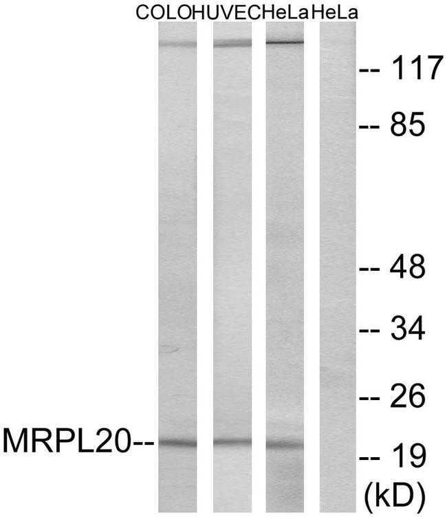 MRPL20 Antibody in Western Blot (WB)