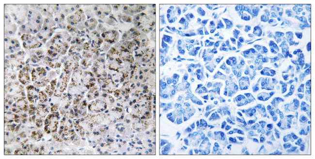 MRPL40 Antibody in Immunohistochemistry (Paraffin) (IHC (P))